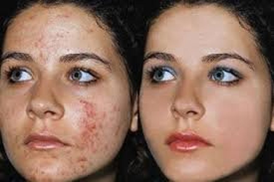 뷰티크레딧다나한에코퓨어화이트닝스킨