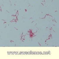 간균(Gram Negative Bacillus)