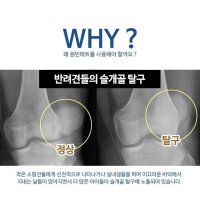 개매트 애견 강아지 반려견 미끄럼 소음 방지 안전 방수 매트 1M