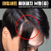 엠라인 헤어패치 테이프세트 M형 (중)