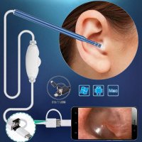 이어 캔들 귀지 귀 청소기 내시경 카메라 otoscope for 키트 청소 홍현희