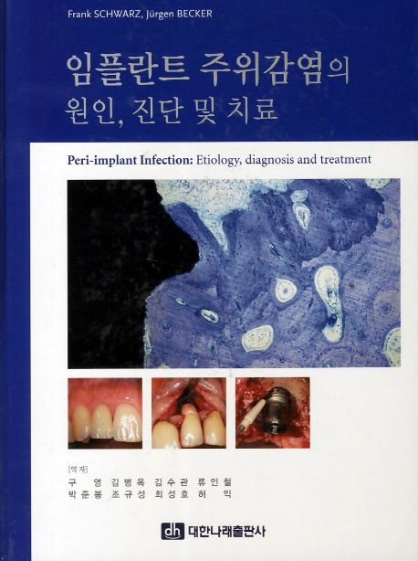 임플란트 주위감염의 원인, 진단 및 치료