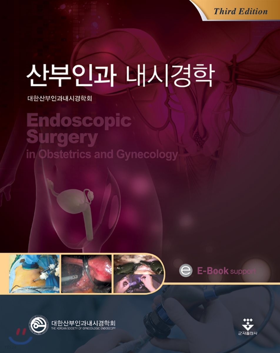 산부인과 내시경학  = Endoscopic surgery in obstetrics and gynecology