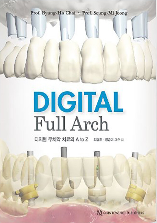 Digital full arch: 디지털 무치악 치료의 A to Z