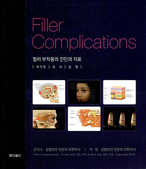 필러 부작용의 진단과 치료