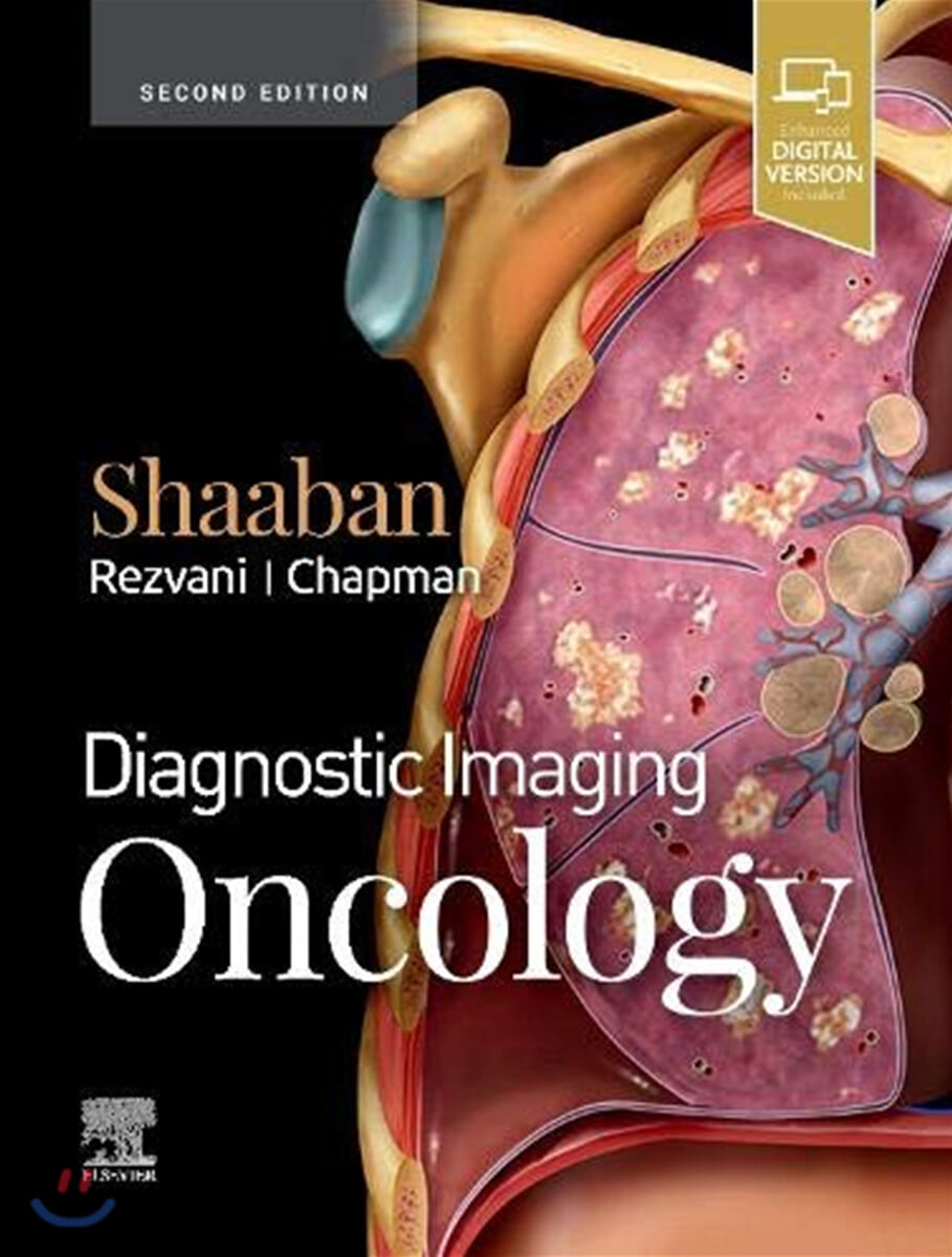 Diagnostic Imaging : Oncology, 2/E
