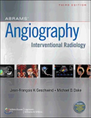 Abrams’ Angiography (Interventional Radiology)