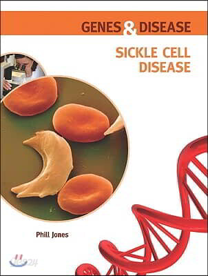Sickle Cell Disease