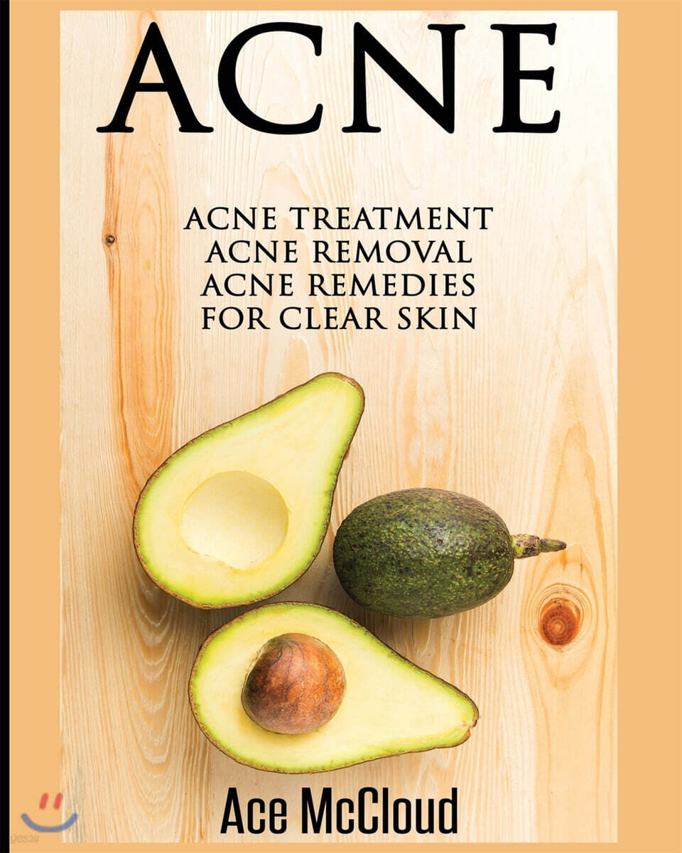 Acne (Acne Treatment: Acne Removal: Acne Remedies for Clear Skin)