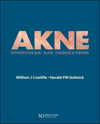 Acne (Diagnose und Therapie)