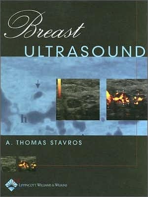 Breast ultrasound