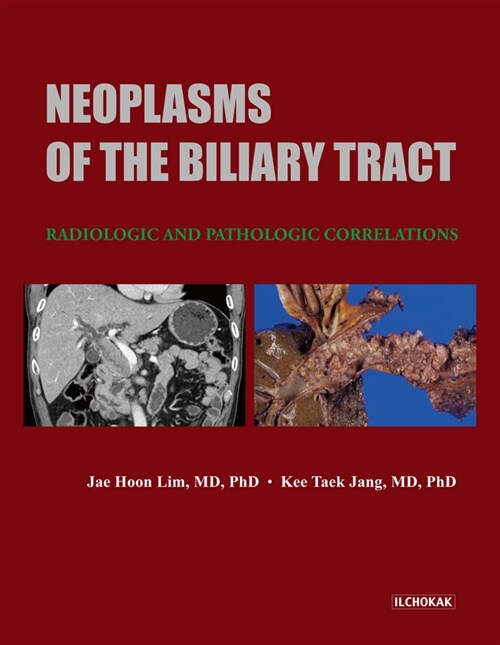 Neoplasms of the biliary tract  : radiologic and pathologic correlations