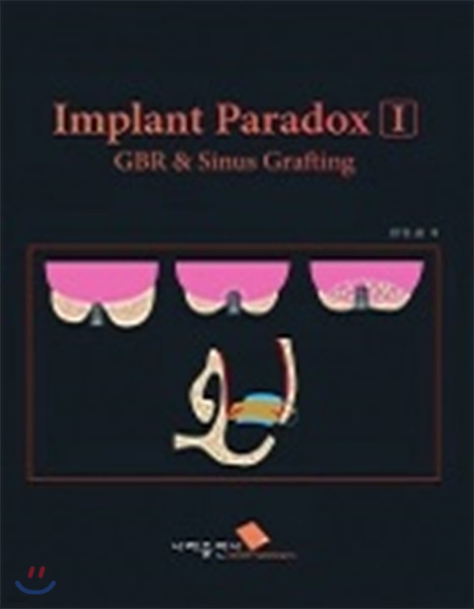 Implant Paradox I GBR & Sinus Grafting