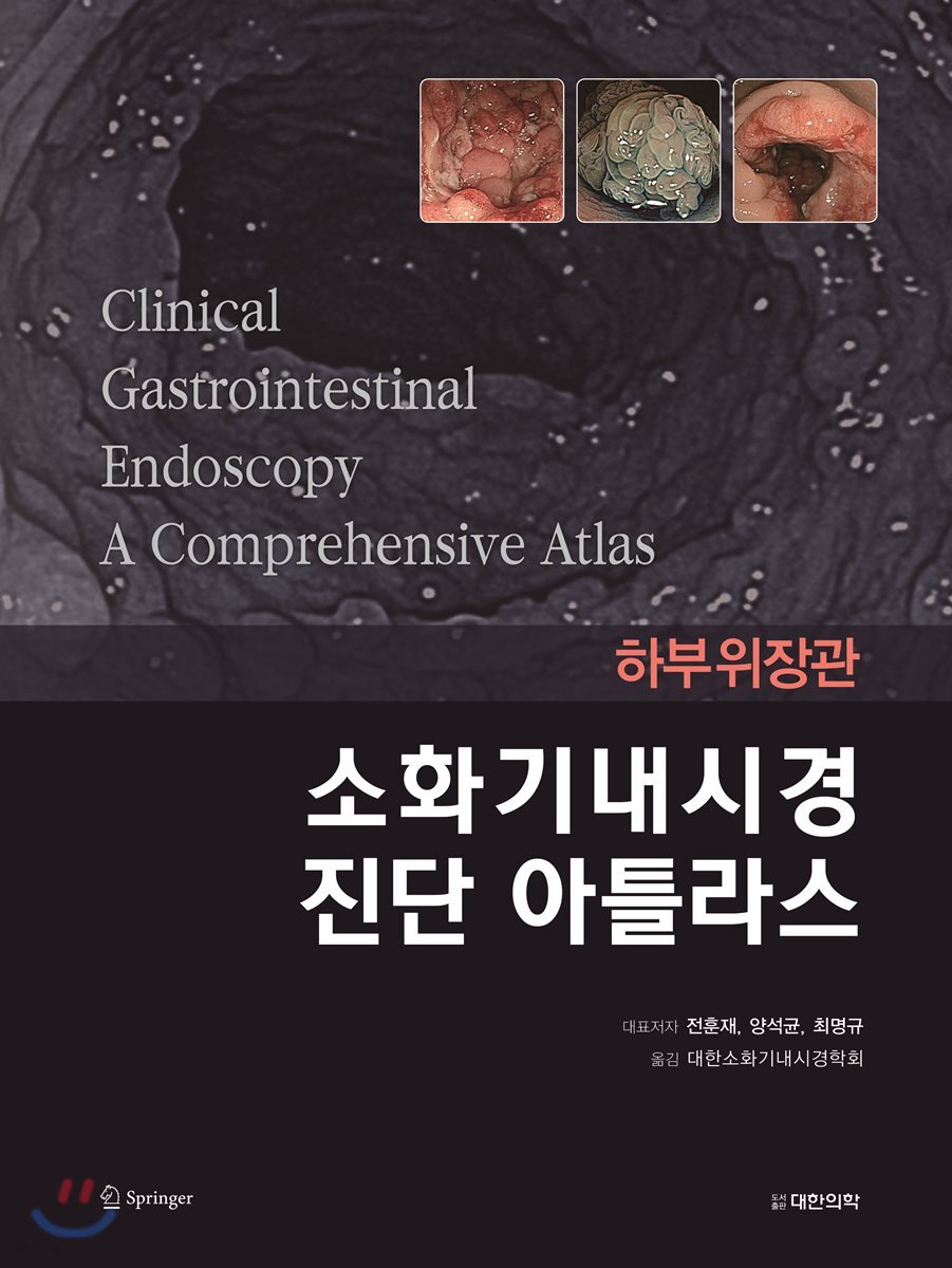 소화기내시경 진단 아틀라스 : 하부위장관