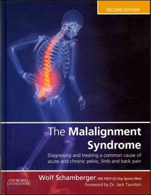 (The)malalignment syndrome  : implications for medicine and sport