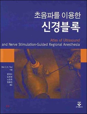 (초음파를 이용한) 신경블록