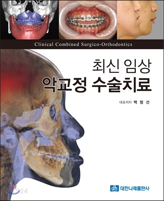 (최신 임상) 악교정 수술치료