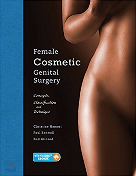 Female Cosmetic Genital Surgery (Concepts, Classification and Techniques)