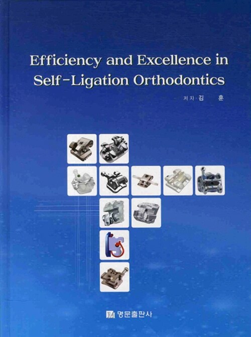 Efficiency and excellence in self-ligation orthodontics