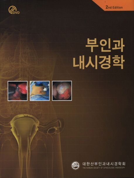 부인과 내시경학(2ND EDITION)