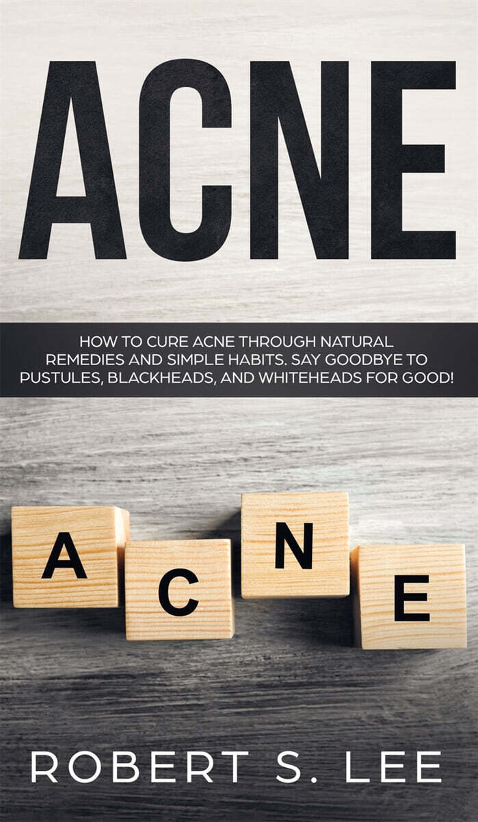 Acne (How to Cure Acne through Natural Remedies and Simple Habits. Say Goodbye to Pustules, Blackheads and Whiteheads for Good!)