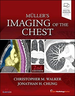 Muller’s Imaging of the Chest, 2/E