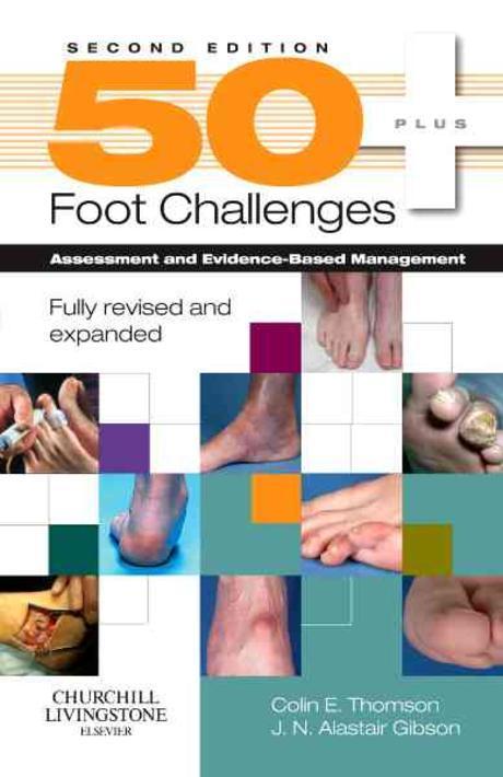 50 + foot challenges : assessment and evidence-based management