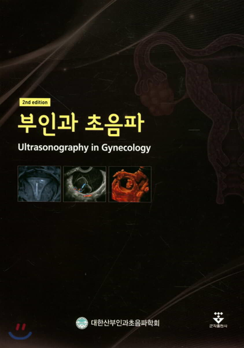 부인과 초음파 = Ultrasonography in gynecology