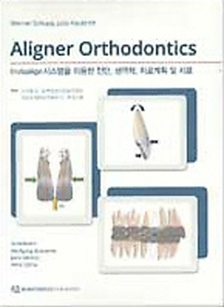 Aligner orthodontics : invisalign 시스템을 이용한 진단, 생역학, 치료계획 및 치료
