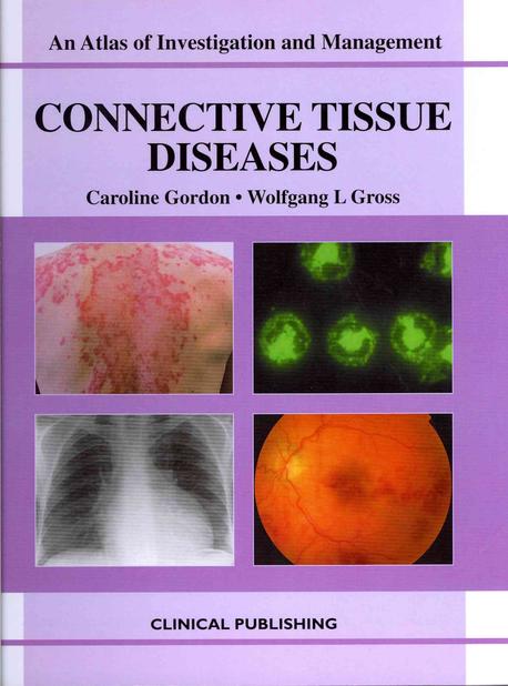 Connective Tissue Disorders: An Atlas of Investigation and Management (An Atlas of Investigation and Management)