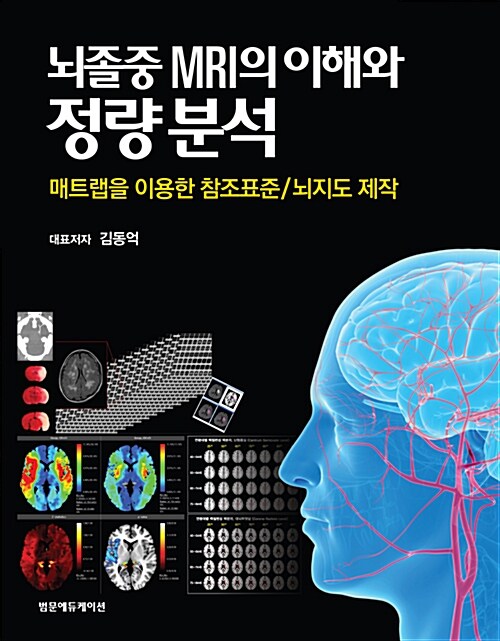 뇌졸중 MRI의 이해와 정량분석  : 매트랩을 이용한 참조표준/뇌지도 제작