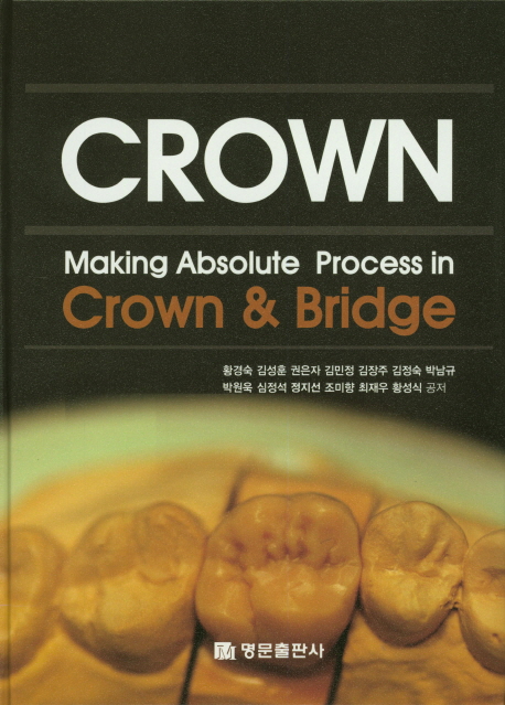 Crown (Making Absolute Process in Crown&Bridge)