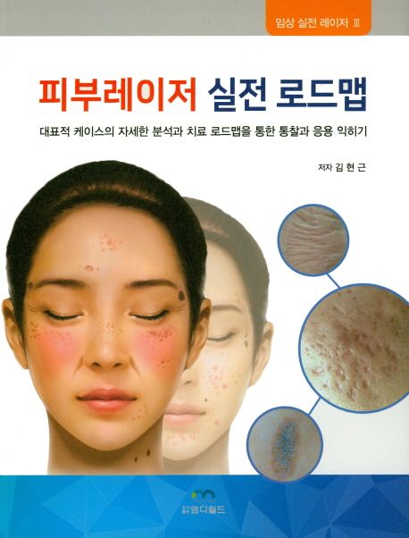 피부레이저 실전 로드맵