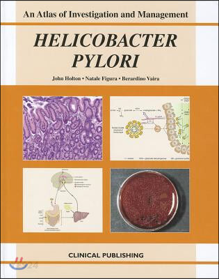 Helicobacter Pylori (Atlas of Investigation and Management)
