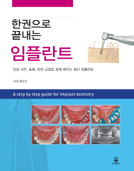 (한권으로 끝내는)임플란트 = (A)step by step guide for implant dentistry  : 임상 사진, 도해, 문헌 고찰로 쉽게 배우는 최신 임플란트