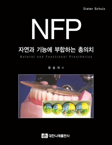 NFP : 자연과 기능에 부합하는 총의치