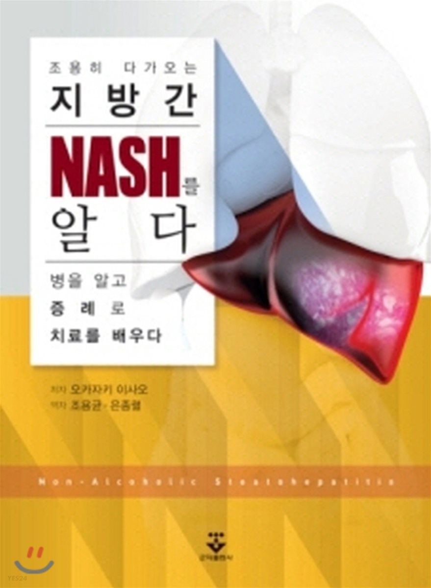조용히 다가오는 지방간 : NASH를 알다  : 병을 알고 증례로 치료를 배우다 / 저자: 오카자키 이...