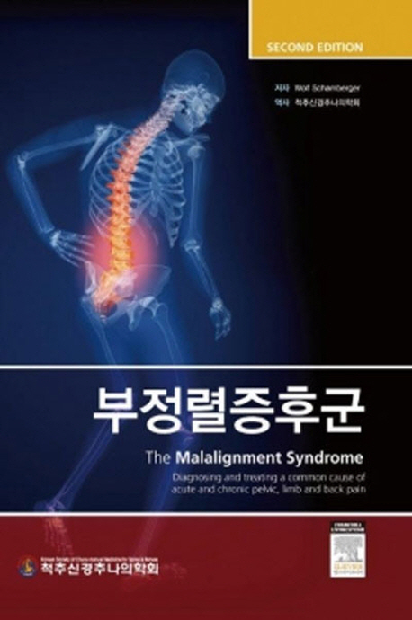 부정렬증후군
