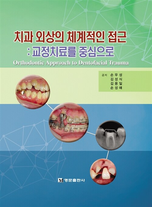치과 외상의 체계적인 접근 (교정치료를 중심으로)