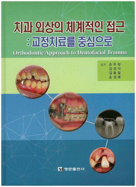치과 외상의 체계적인 접근: 교정치료를 중심으로 (교정치료를 중심으로)