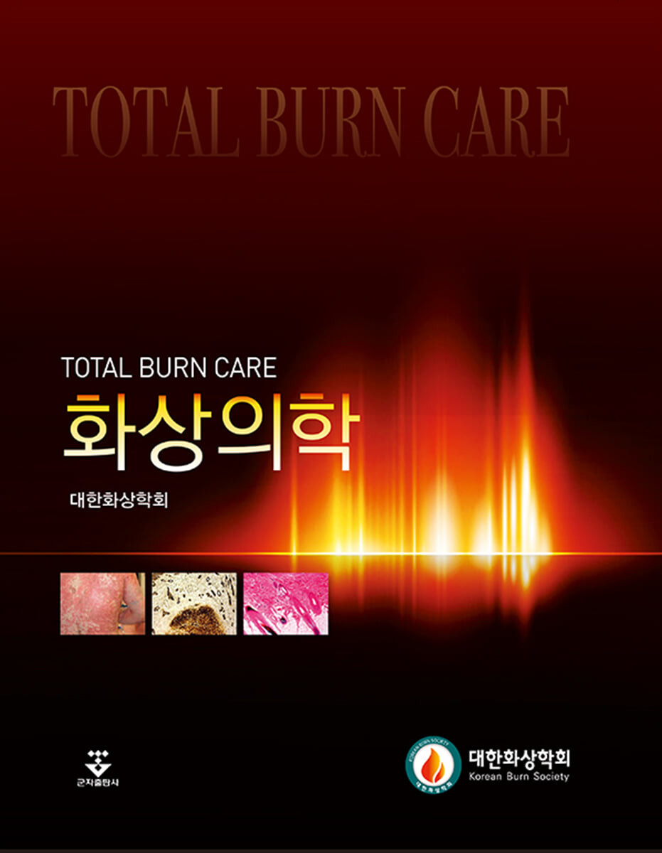 화상의학  = Total burn care