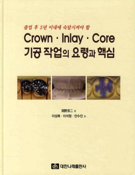 (졸업 후 5년 이내에 숙달시켜야 할)crown·inlay·core 기공 작업의 요령과 핵심