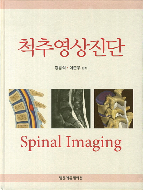 척추영상진단  = Spinal imaging / 강흥식 [외저].
