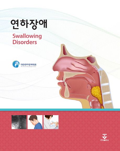 연하장애 = Swallowing disorders