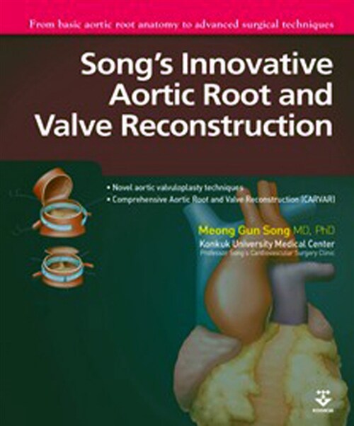 Song's innovative aortic root and valve reconstruction : from basic aortic root anatomy to...