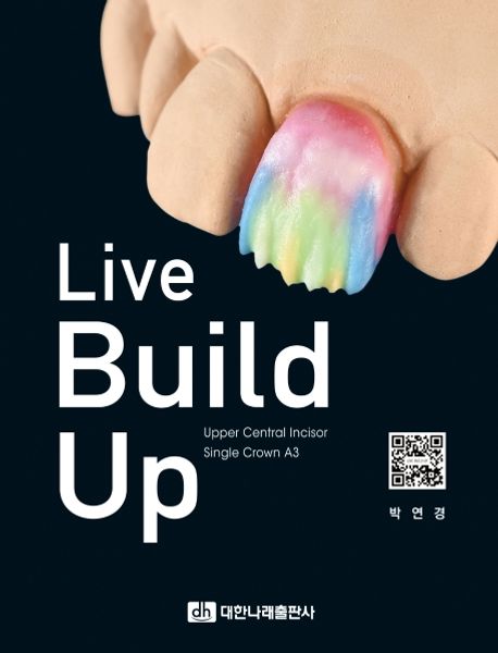 Live build up: upper central incisor single crown A3
