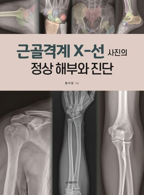 근골격계 X-선 사진의 정상 해부와 진단