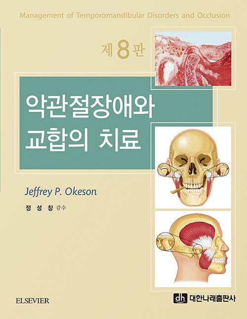악관절장애와 교합의 치료