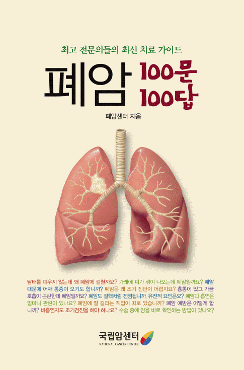 폐암 100문 100답 : 최고 전문의들의 최신 치료 가이드