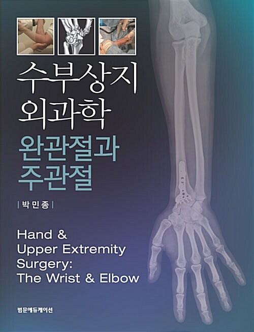 수부상지 외과학 : 완관절과 주관절  = Hand & upper extremity surgery : the wrist & elbow / ...